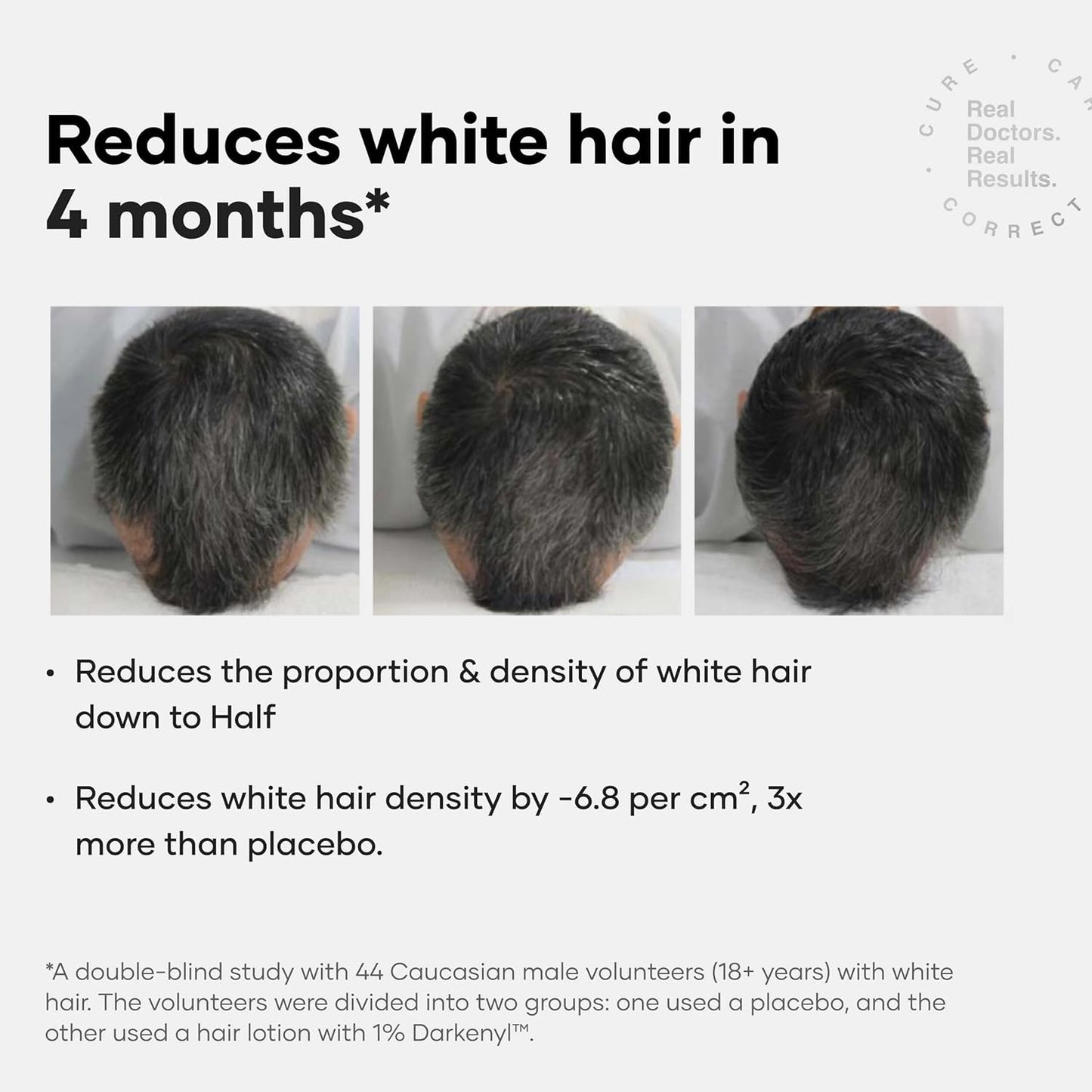 Cureskin Anti Grey Hair Serum - Gradually Restores Natural Hair Color | Peptide-52 & Acetyl Tyrosine | 15-Day Supply