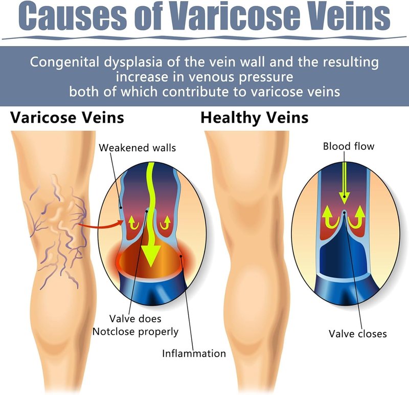 Varicose Veins Patch - 36PCS Natural Relief for Spider Veins | Strengthen Capillary Health & Improve Circulation