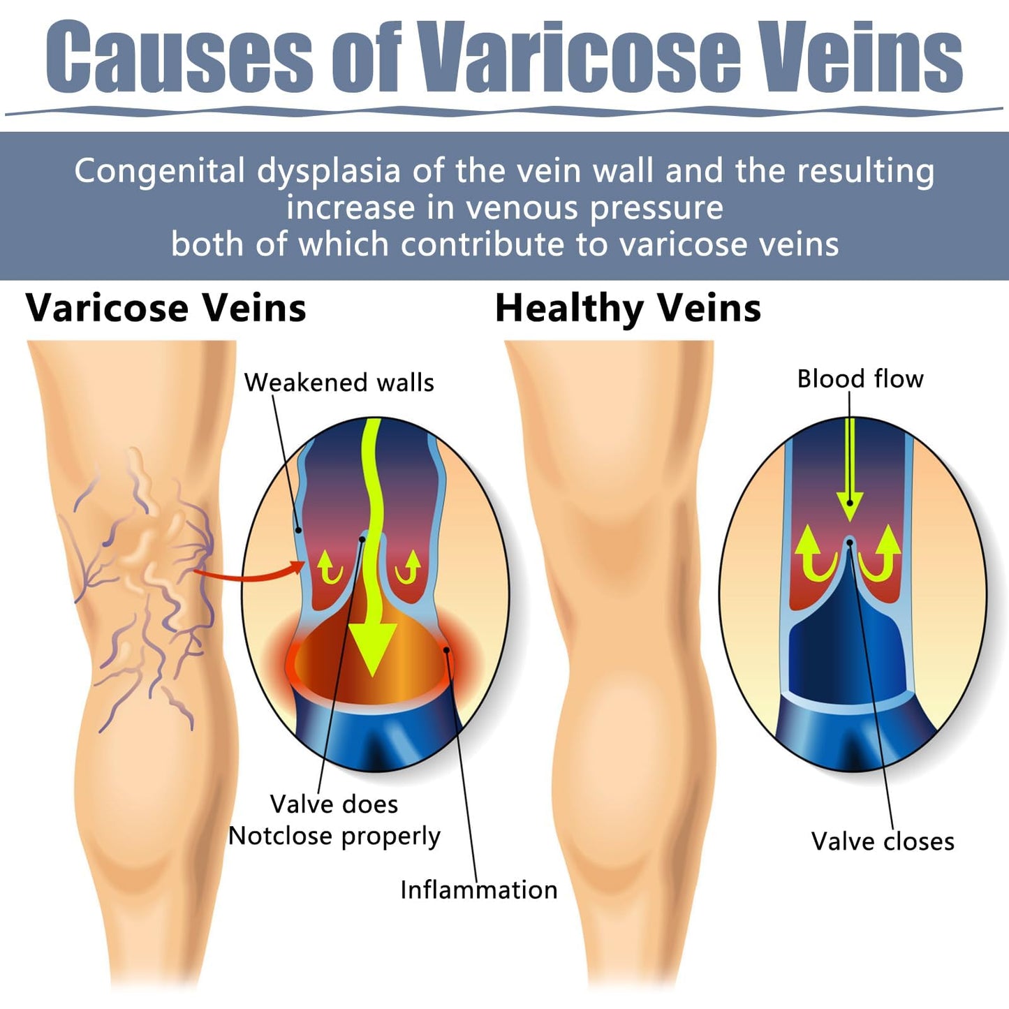 Jawfait 36PCS Varicose Veins Patch - Natural Relief Treatment for Legs, Spider Varicose Vein, Strengthen Capillary Health and Improve Blood Circulation