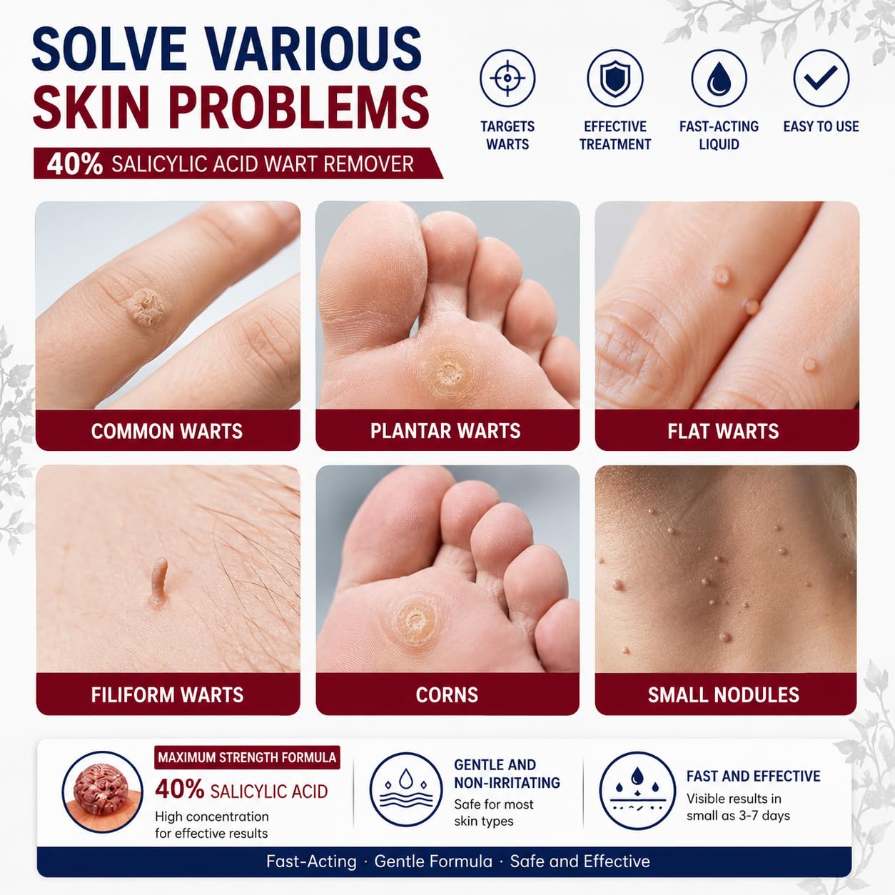 QQE 40% Salicylic Acid Wart Remover Liquid for Feet & Body, Maximum Strength Plantar Wart Remover for Feet, Fast-Acting Wart Remover for Common, Flat & Foot Warts, Easy-to-Use Wart Remover Liquid