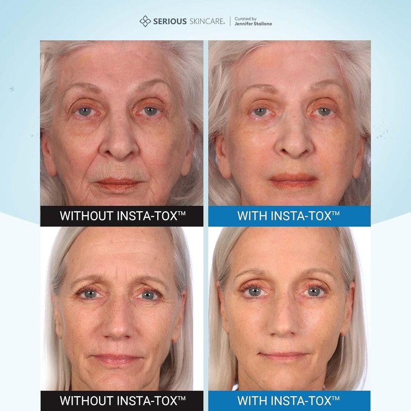 Serious Skincare INSTA-TOX Instant Wrinkle Filler Serum - Smooth Fine Lines & Deep Wrinkles | 0.75 oz