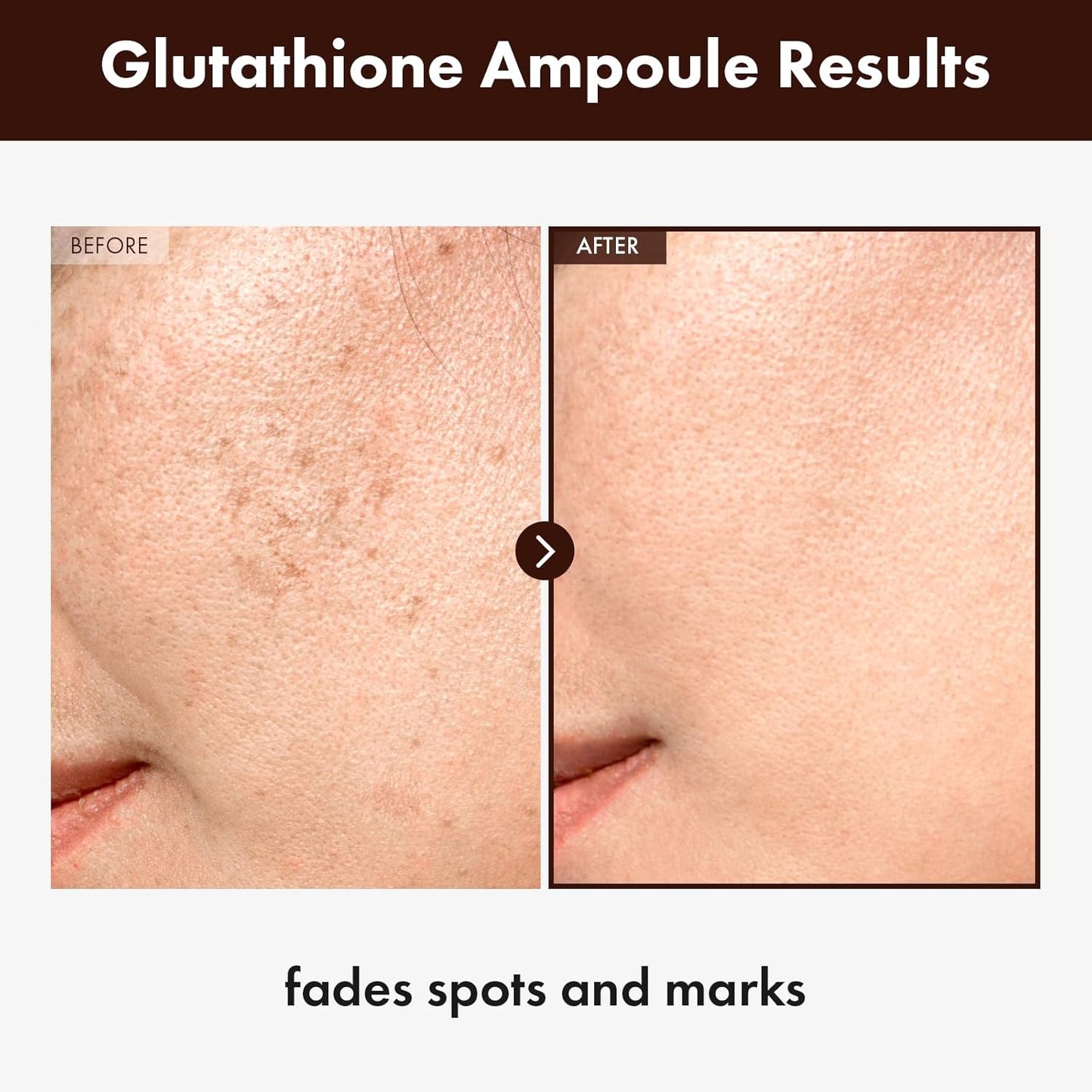 Glutathione Serum 20,000ppm - Brighten Dark Spots & Revitalize Skin | 30ml Korean Skincare