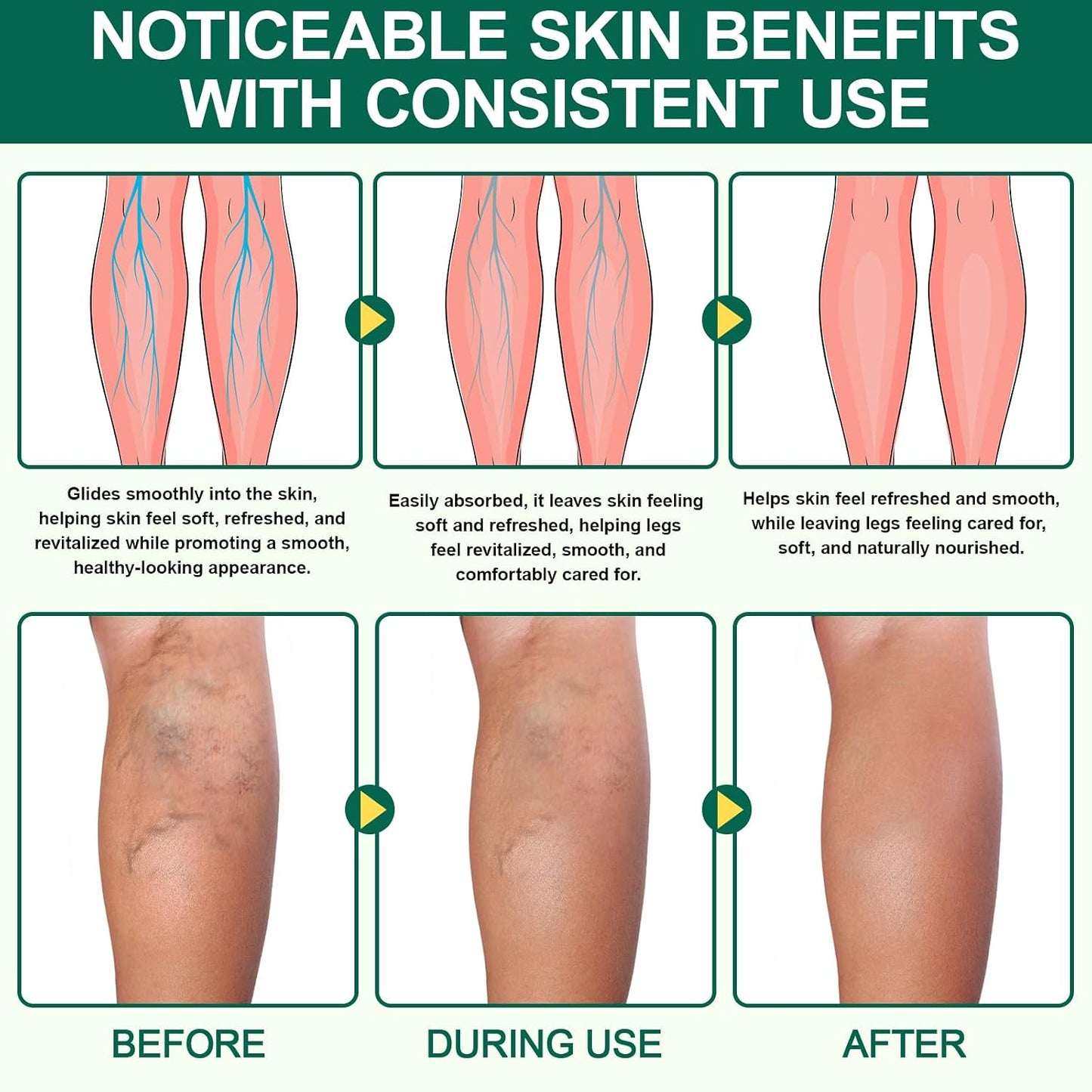 Miracle Balm - Natural Relaxation Balm for Legs, Arms & Back | 2 Boxes