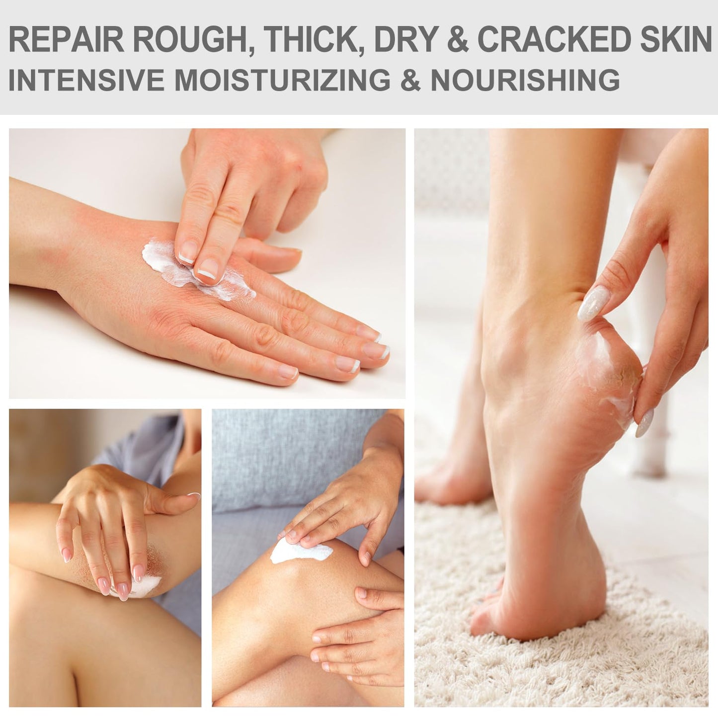 Mouriven Urea Cream 40 Percent - Foot & Hand Cream for Dry, Cracked Heels, Feet, Knees, Elbows, and Hands - Maximum Strength Urea Lotion for Softening and Moisturizing