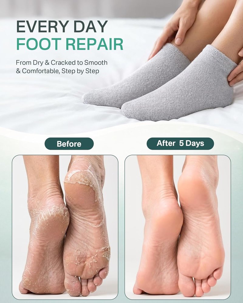 Moisturizing Socks for Dry Cracked Feet - Aloe Gel Heel Protector | Size 9-11, Foot Spa Care