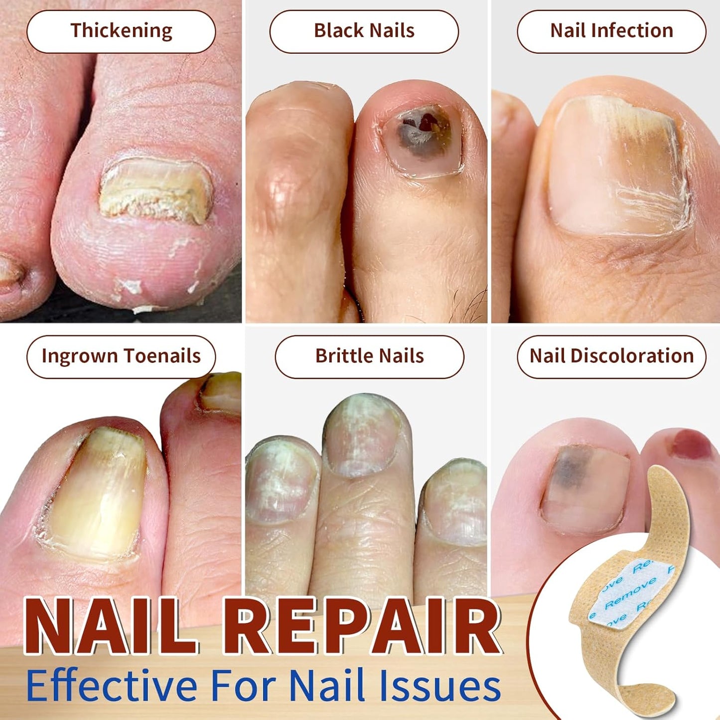 Fungal Nail Patches - 4 Pack Toenail Repair Patches for Discolored & Damaged Nails | 84 Count, 9-Hour Adhesion