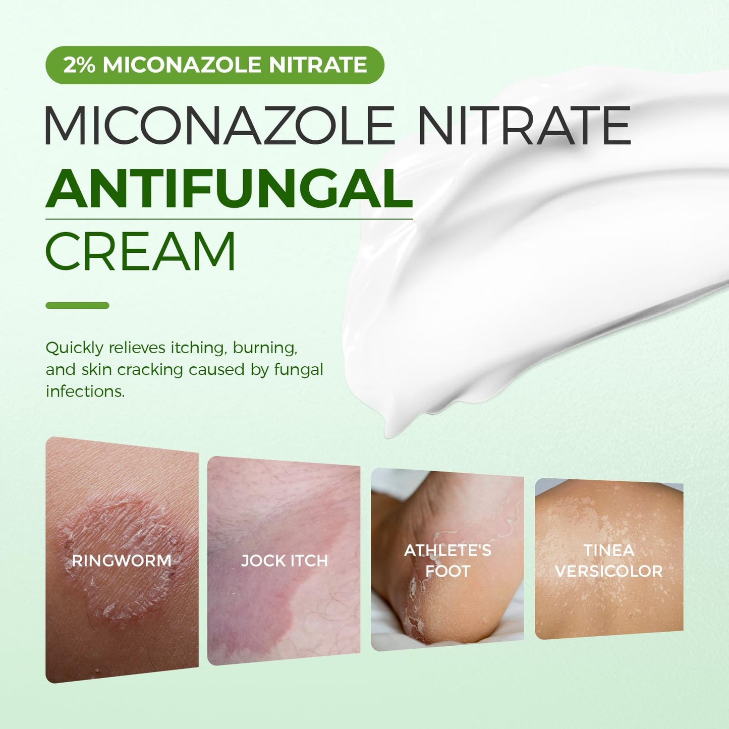Inlifay 2% Miconazole Antifungal Cream: Helps relieve the itching, burning, cracking, and scaling associated with fungal infections such as athlete's foot,jock itch, and ringworm(3.52 OZ)