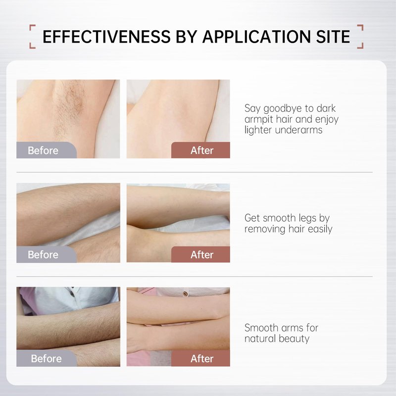VGO Painless Hair Removal Lotion for Women & Men - For Unwanted Hair, All Skin Types, White, 4.02 oz