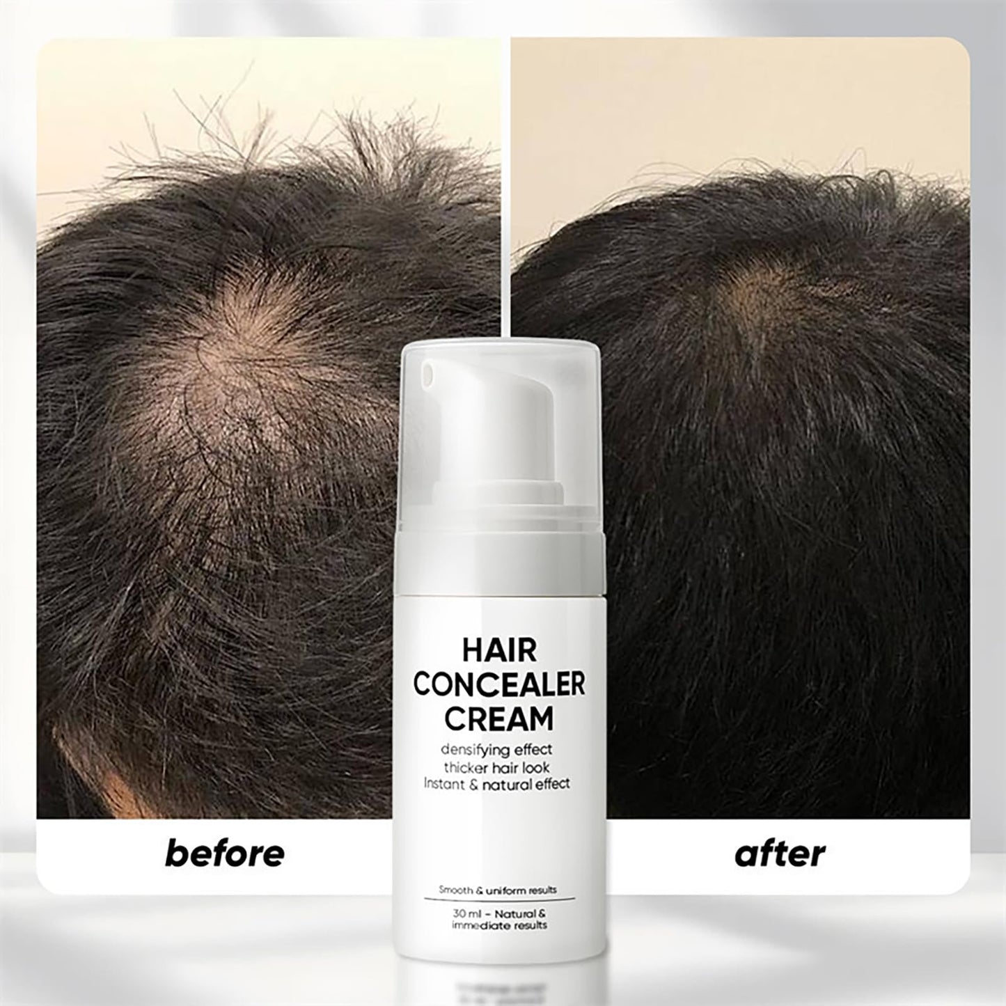 Hair Concealer Cream for Thinning Hair & Bald Spots, Black Root Touch-Up, Waterproof & Sweatproof Scalp Coverage, Natural Filling Cream for Men & Women – 30ml