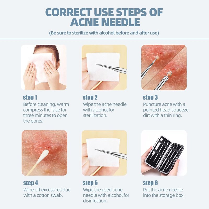 Blackhead Remover Kit - Comedone Extractor Tool for Acne Treatment | 6-Piece Set