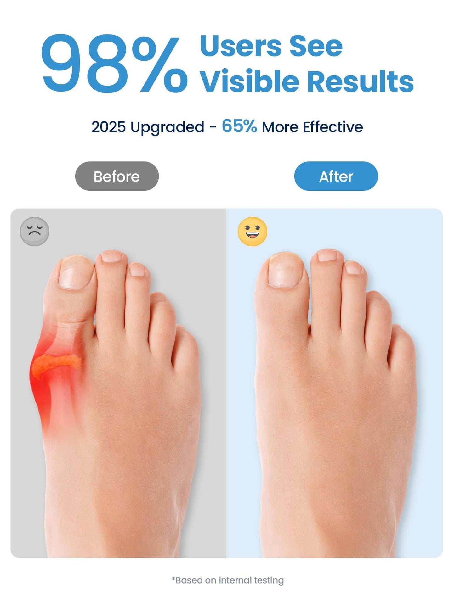 Habioer Toe Separators for Women - Podiatrist Recommended, Toe Spacers for Men, Breathable Bunion Corrector, Plantar Fasciitis(1 Pair)
