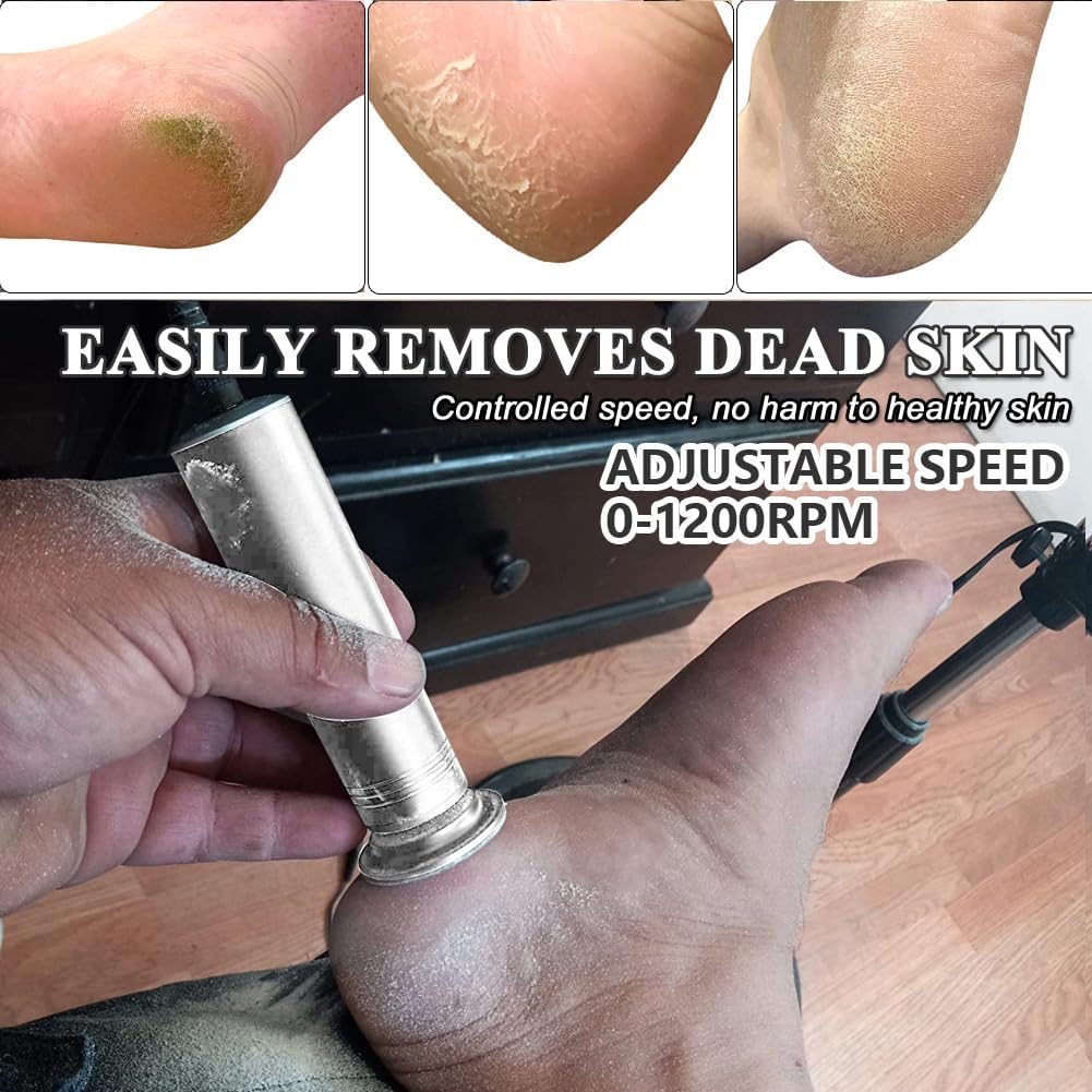 Electric Callus Remover - Professional 1200RPM Foot File with Adjustable Speed & 60 Sandpaper Discs | Silver