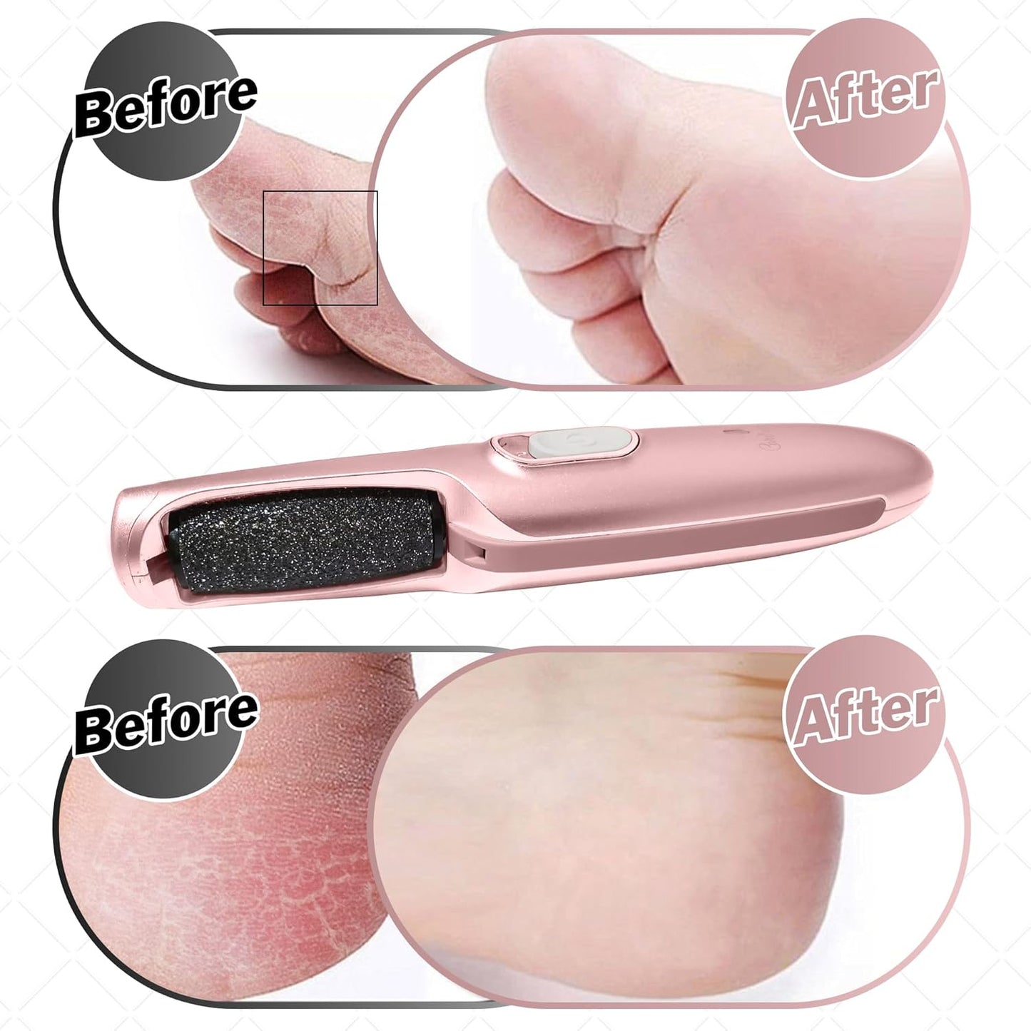Electric Callus Remover Wand - Rechargeable Foot File & Scrubber for Soft, Smooth Feet | Rose Gold