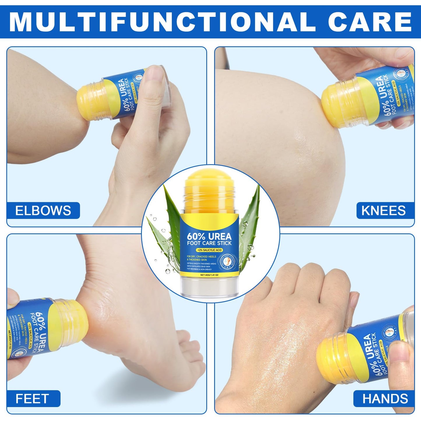 ZIXAOK 60% Urea with 2% Salicylic Acid Urea Foot Care Stick, Maximum Strength Foot Cream Stick for Dry, Cracked Feet, Knees, Elbows & Hands, Callus Remover & Skin Softener, 1.4oz