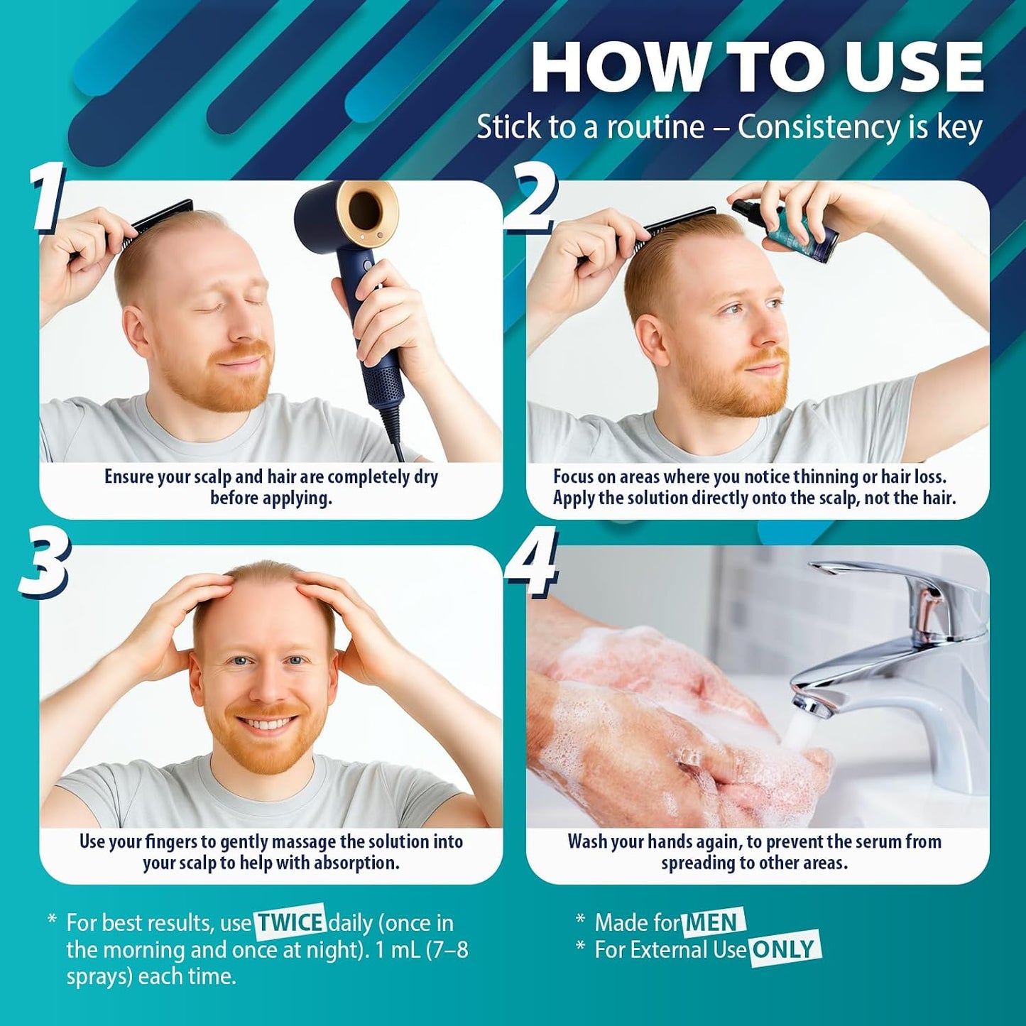Minoxidil Hair Growth Oil for Men - Beard & Hair Spray with Biotin, Ginger & Lavender Extracts | 5% Solution