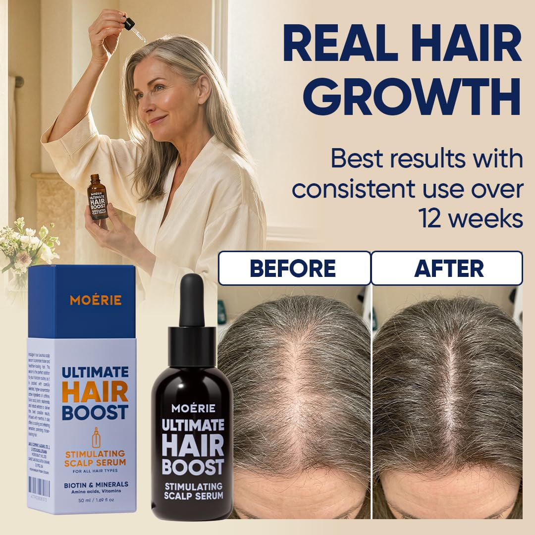 Ultimate Hair Growth Serum - Natural Hair Regrowth & Thickening Treatment for Women - 1.69 fl oz / 50 ml