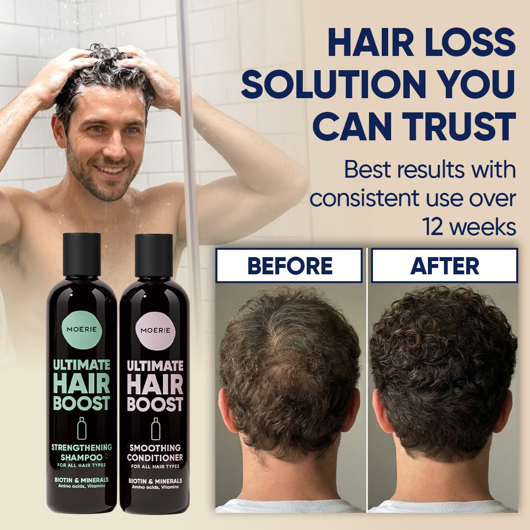 Moerie Hair Growth Shampoo and Conditioner for Women and Men, Hair Loss Solution with Biotin and Rosemary, Thickening Shampoo and Conditioner for Thinning Hair – Promotes Regrowth, Double Set