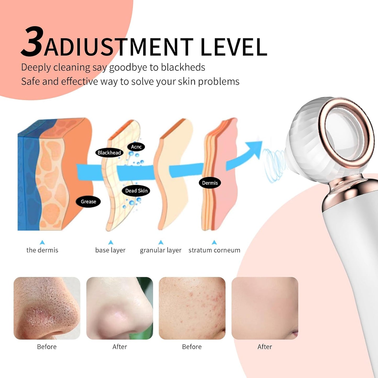 Blackhead Remover Pore Vacuum - Rechargeable Facial Cleaner with 3 Soft Silicone Probes | USB Electric Acne Extractor Tool