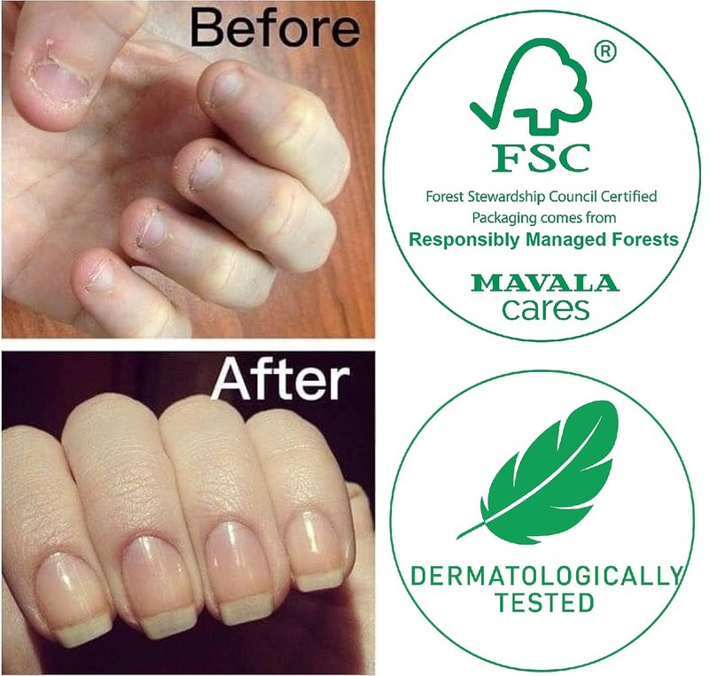 Mavala Stop Nail Polish Treatment - Bitter Taste Deterrent for Nail Biting | Easy Application for Ages 3+ | 0.3 Fl Oz
