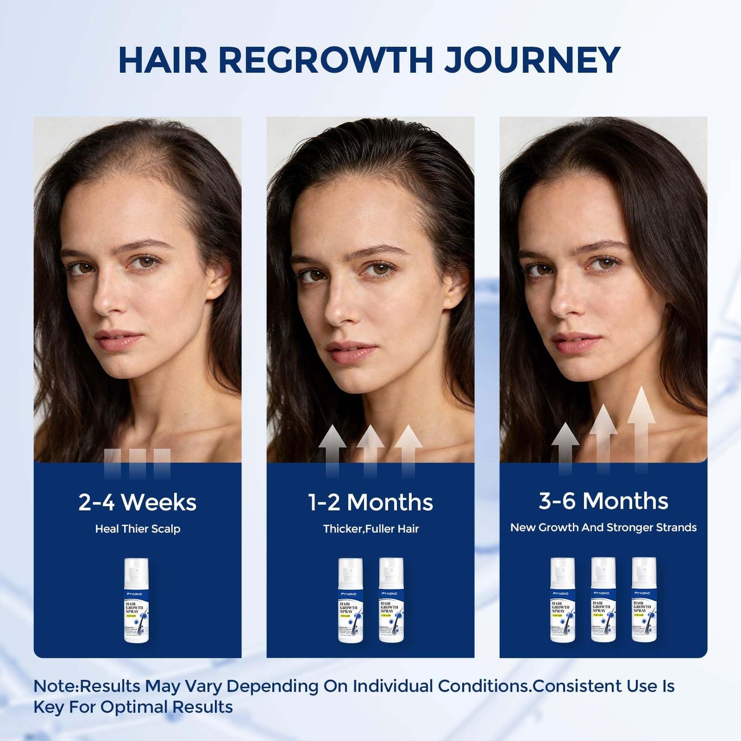 FYNONO Hair Growth Spray,Hair Growth Serum for Women & Men,Hair Regrowth Treatment with Biotin & Rosemary Oil,Hair Loss Treatment Spray for Thinning Hair,Non-Greasy Scalp Care,2.029 Fl Oz