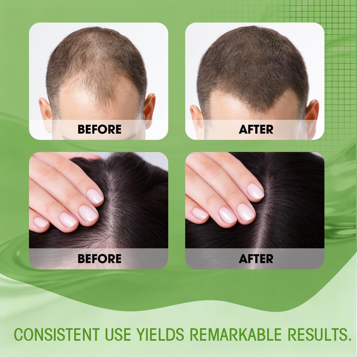 Hair Regrowth System - Hair Growth Treatment with Ginseng, Eclipta Prostrata, Peppermint & Ginger Root, Fast-Absorbing Non-Greasy Serum to Strengthen Roots, Thicken Hair for Men & Women