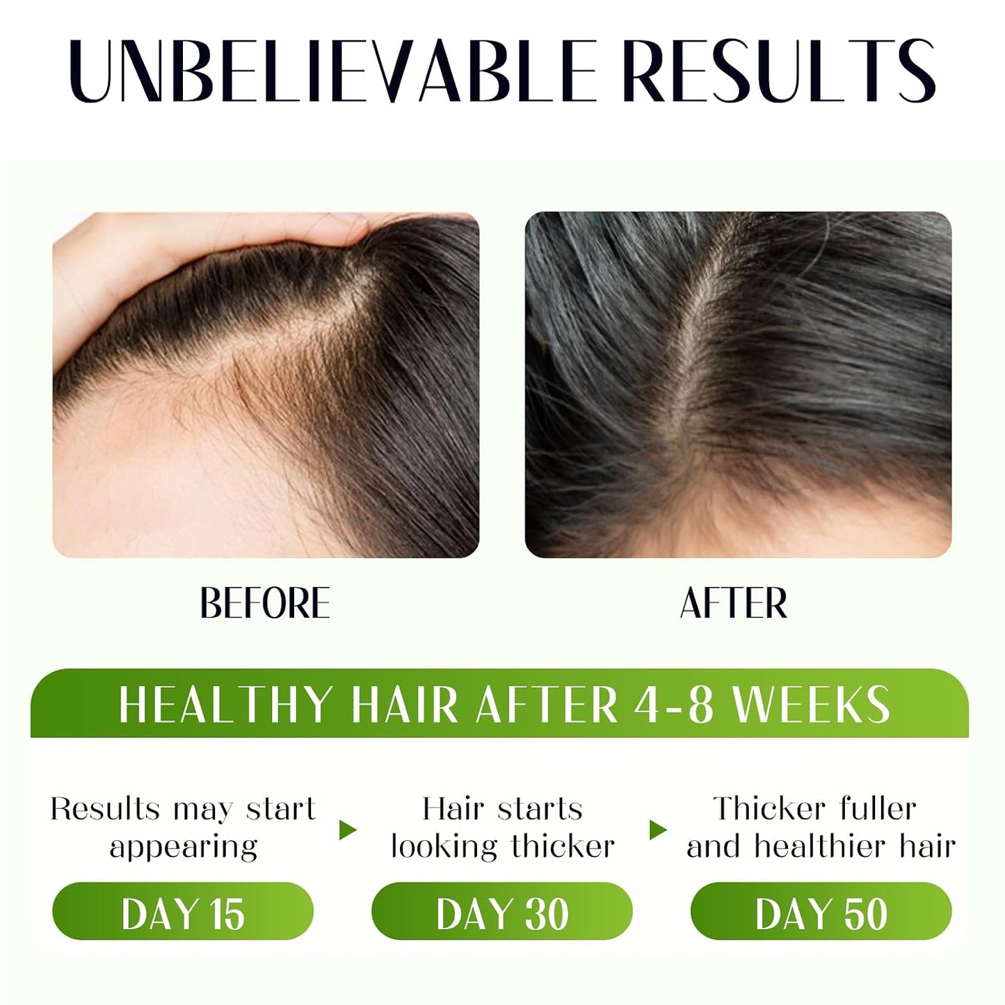 Batana Oil for Hair Growth - 4-in-1 Formula with Rosemary, Castor Oil & Biotin | Scalp Care & Hair Repair