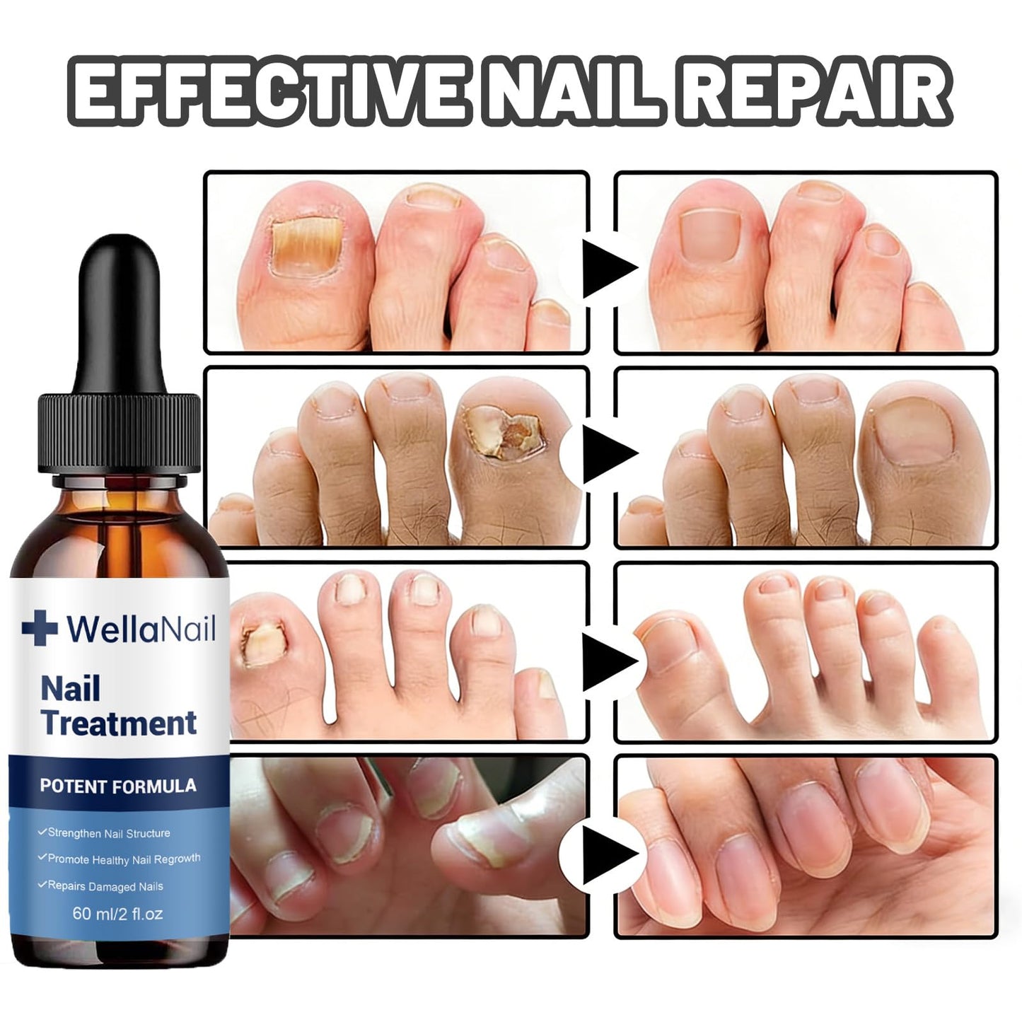 Wellanail Treatment, All Natural WellaNail Premium Support for Overall Health, Make Nails Look Healthier Stronger (Brown)