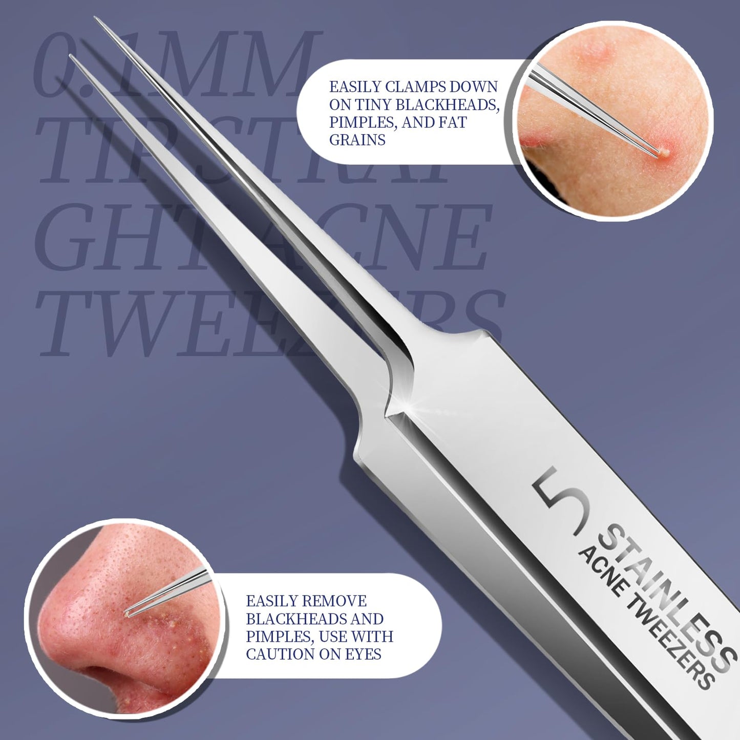 Teenitor 7 Pcs Pimple Popper Tool Kit, Surgical Grade Blackhead Remover Tools, Ingrown Hair Tweezers, Blackhead Extractor Pimple Extractor, Black Head Remover for Face