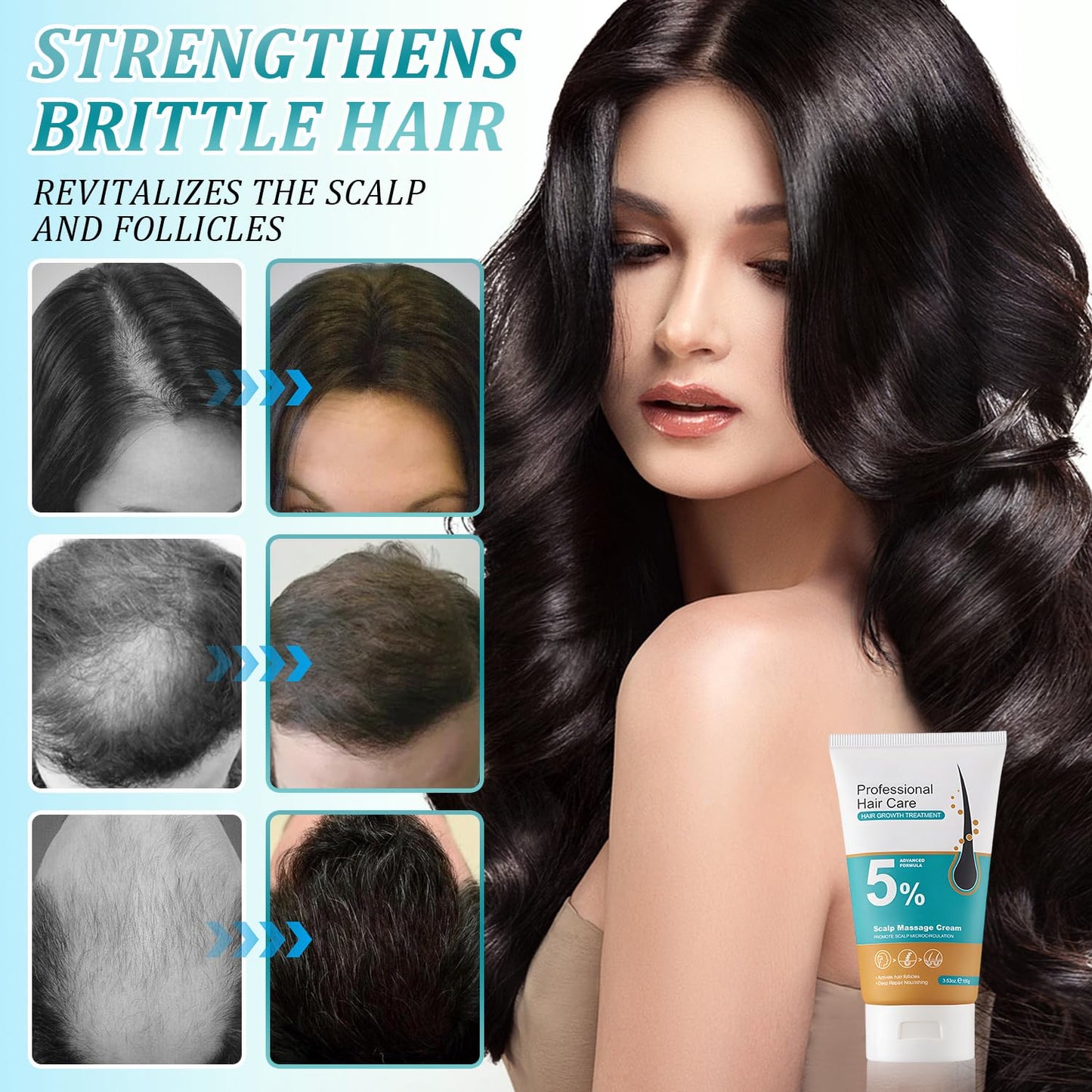 Minoxidil Hair Growth Cream - 2pcs Scalp Massage Treatment with Rosemary & Biotin for Men & Women | Strengthens Hair Roots