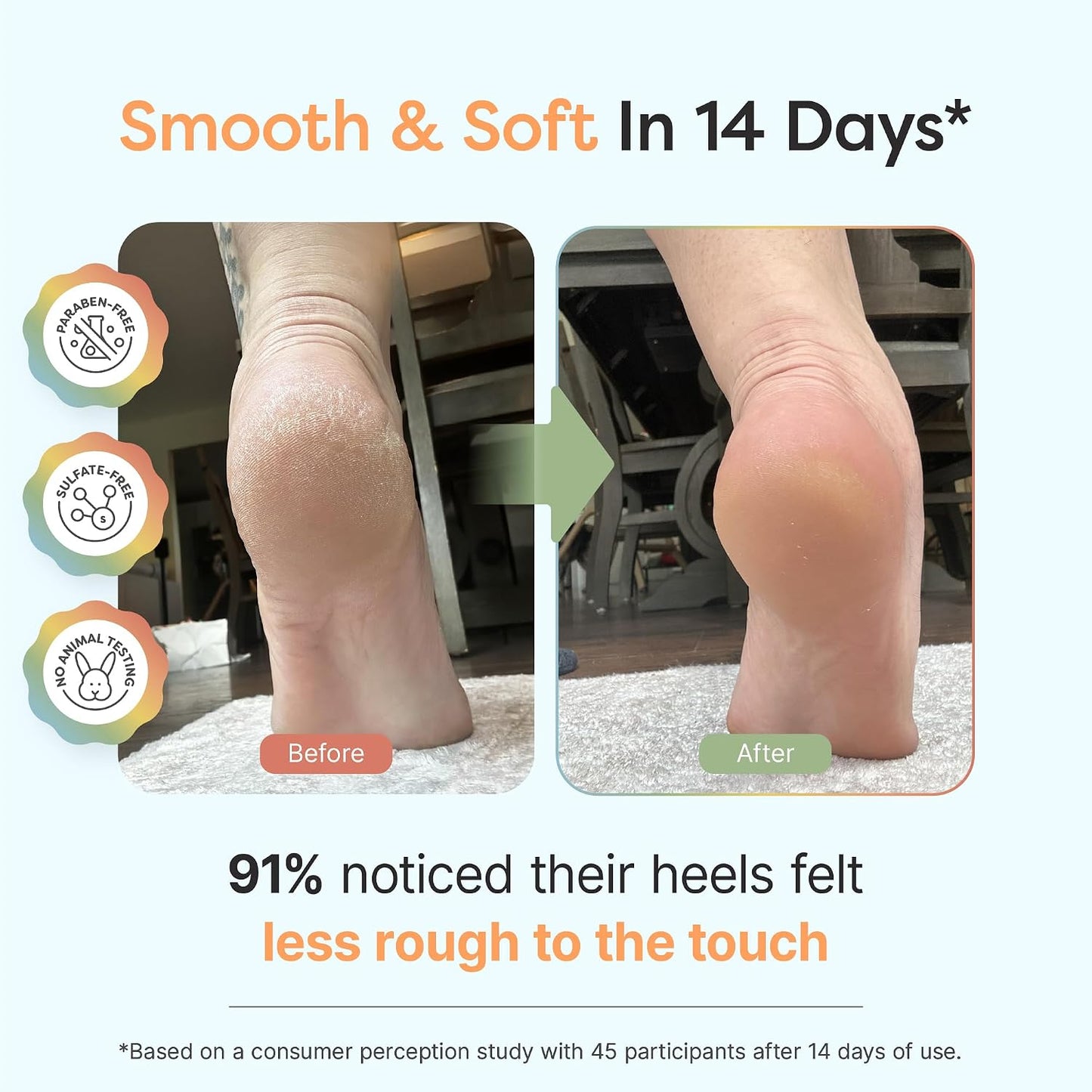 Urea Foot Cream 40% - Softens Dry Cracked Heels & Calluses | Gentle Exfoliating Lavender Cream | 5oz