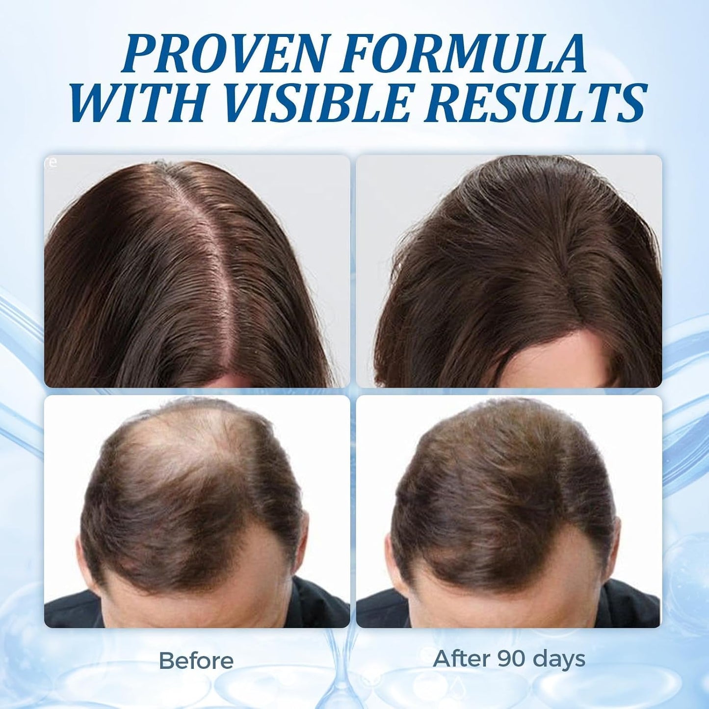 GHK-Cu Peptide Hair Serum - Copper Peptides for Thinning Hair Growth | Lightweight Non-Greasy Formula for Men & Women