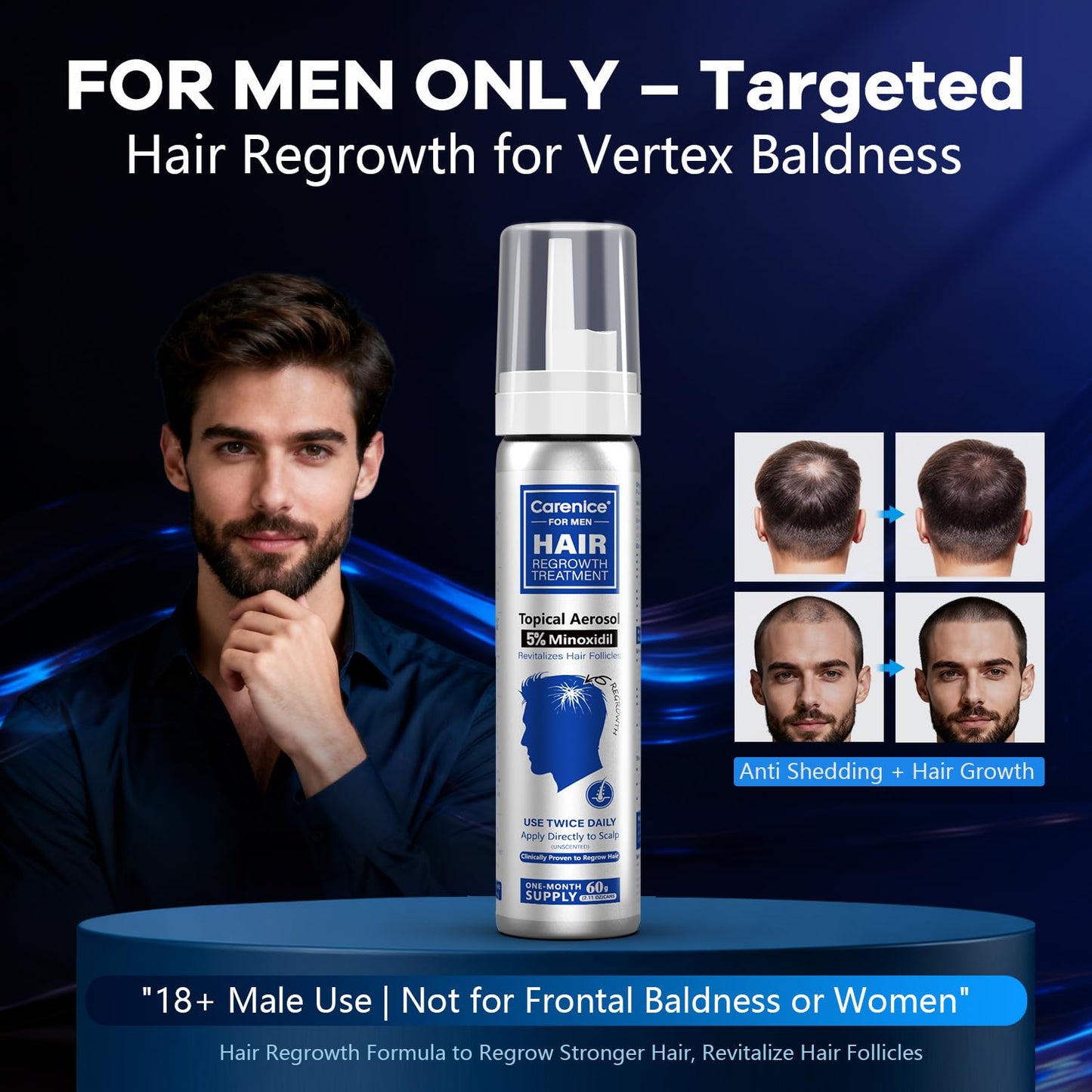 5% Topical Minoxidil Foam, Aerosol Minoxidil for Men, Infused with Biotin, Hair Growth Treatment, Supports Thicker and Fuller Hair & Beard Unscented (Minoxidil Foam, 8.44oz, 4 Months Supply)