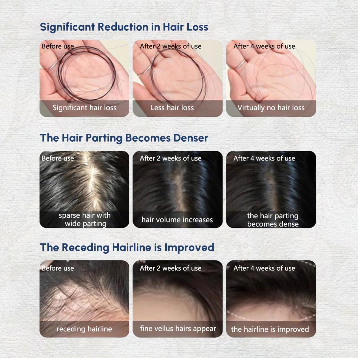 Hair Thickening Scalp Serum, Botanical Care Essence for Men & Women, Anti-Thinning, Strengthen Hair Root, Lightweight Non-Greasy for Dry & Oily Scalp, 30ml