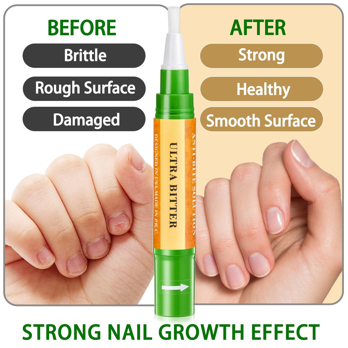 Econail 3 IN 1 Nail Biting Prevention Kit for Kids & Adults -3 Pack Includes Extra Strength+ Gentle Bitter Polish + Cuticle Oil. Fast Drying Formula Stops Nail Biting & Thumb Sucking
