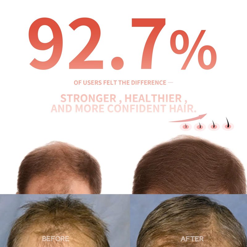 Instyle Egg 272 Pro Max DualWave Laser Cap for Hair Regrowth | Laser Hair Growth Device | Red Light Therapy, Hair Loss Treatment for Men and Women
