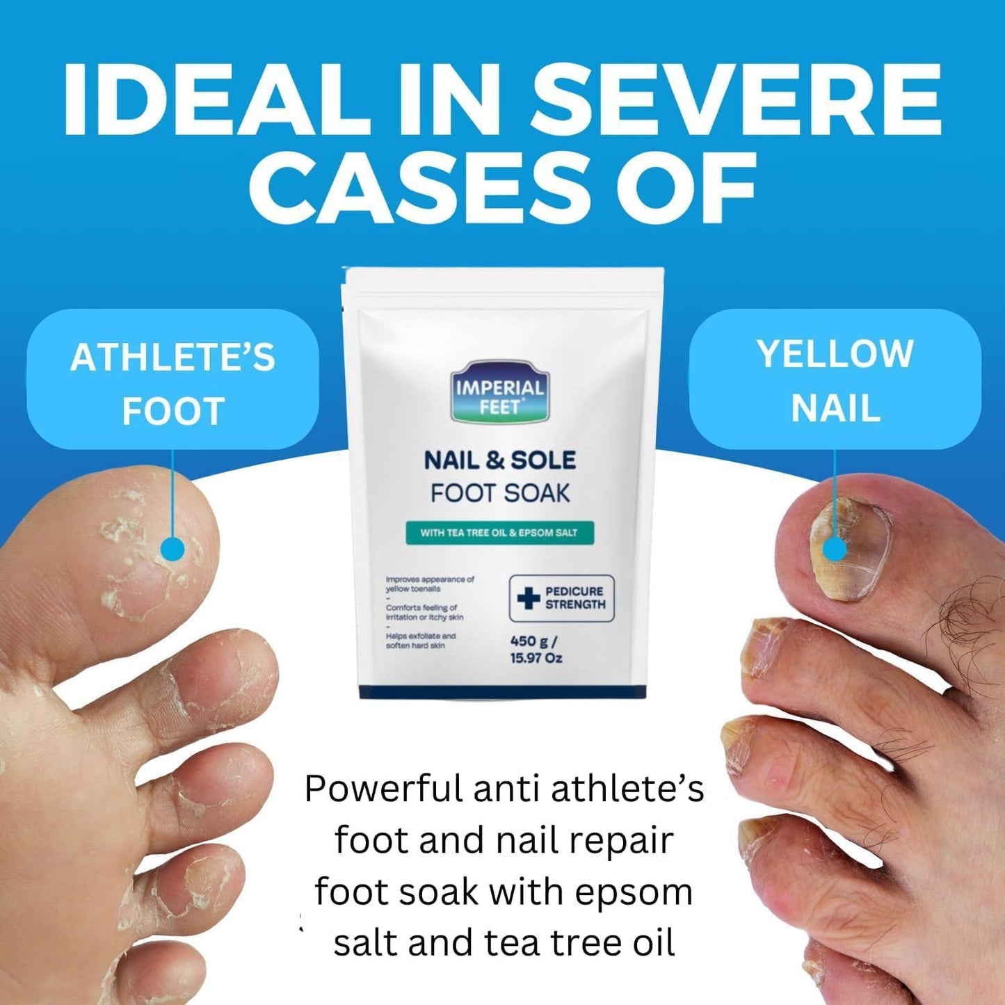Epsom Salt Foot Soak - Pedicure Grade Toenail Repair & Fungus Treatment | 16oz Tea Tree Oil
