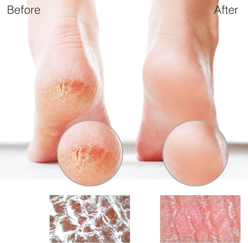 Glass Foot File - Callus Remover & Heel Scraper for Smooth Feet | Professional Pedicure Tool for Diabetic Care