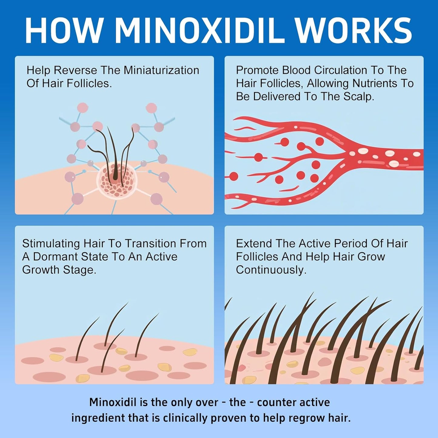 Minoxidil Hair Growth Treatment - 5% with Biotin for Thicker Hair & Beard | 6 Pack, 12 fl oz