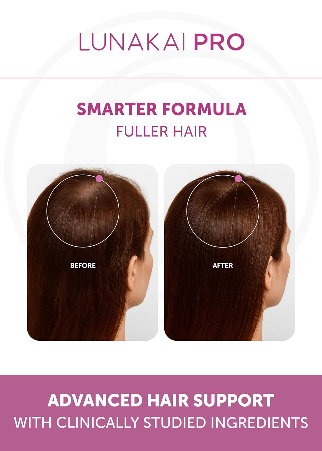 Lunakai Hair Growth Supplement for Women - 20 Nutrient Formula with Marine Collagen & Biotin | 90 Capsules