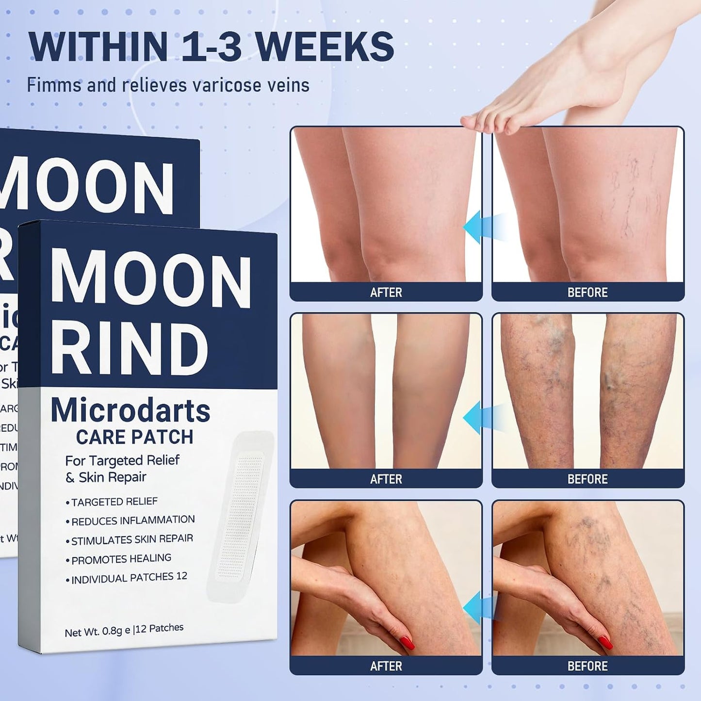 Moonrind Microdarts Care Patch - Relieve Leg Discomfort & Moisturize Skin | 2PCS, Deep Treatment for Fatigue