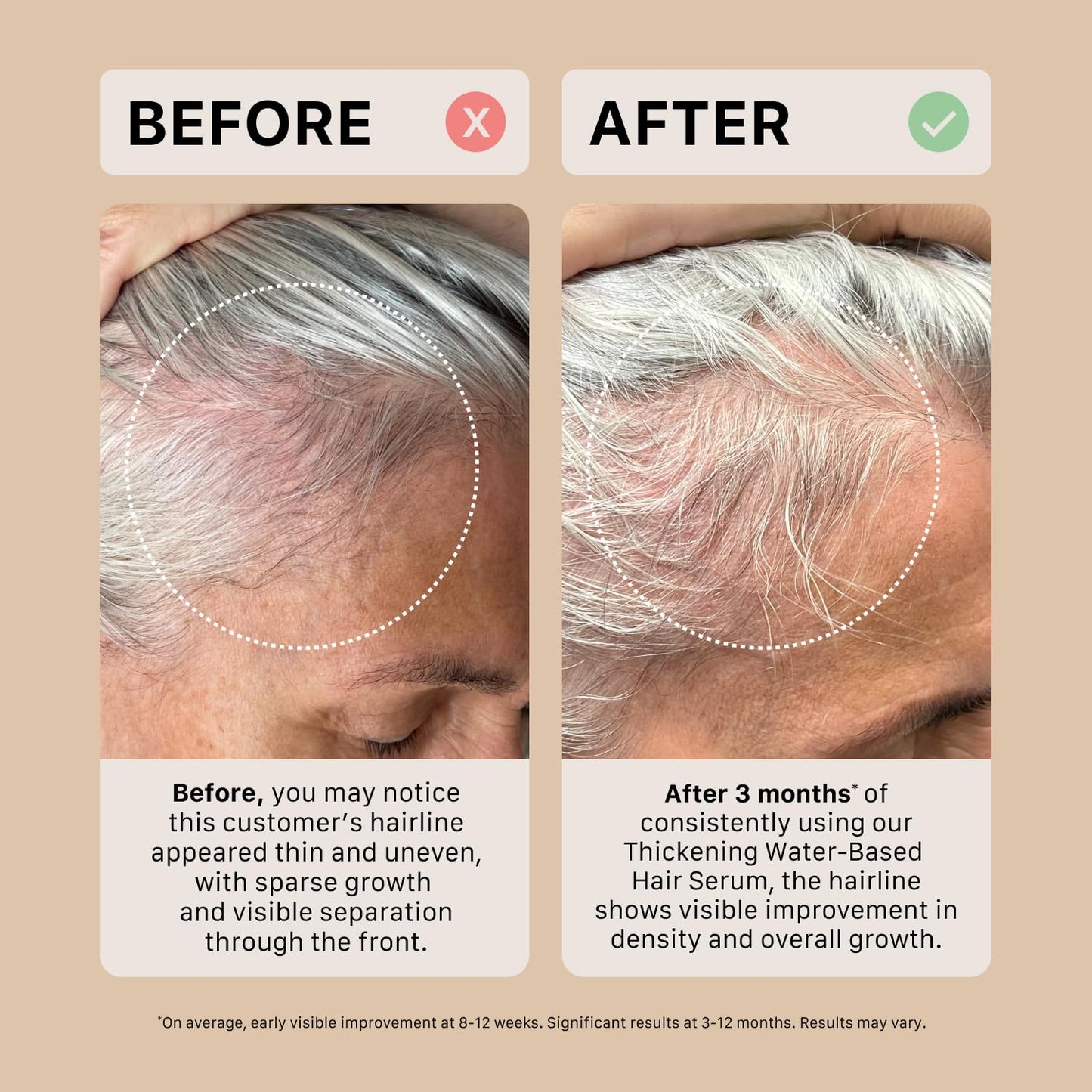 ACTIIV Thickening Hair Serum - Water Based | Supports the Appearance of Thicker, Fuller-Looking Hair, Lightweight Water-Based Formula, Non-Greasy, All Hair Types, 1.8 oz
