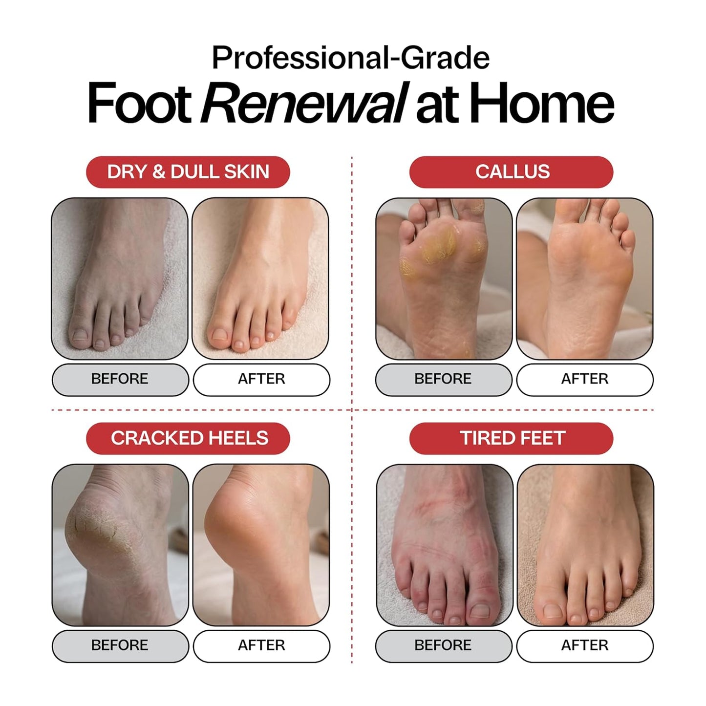 Muscle Soothing Foot Soak - Epsom Salt & Arnica for Soreness Relief | Eucalyptus & Peppermint - 1lb