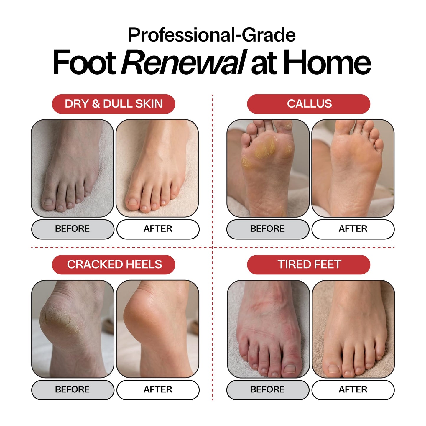 Foot Choice Muscle Soothing Foot Soak with Epsom Salt & Arnica - Relieves Soreness, Eases Tension & Recovery for Athletes - Eucalyptus & Peppermint - 1lb