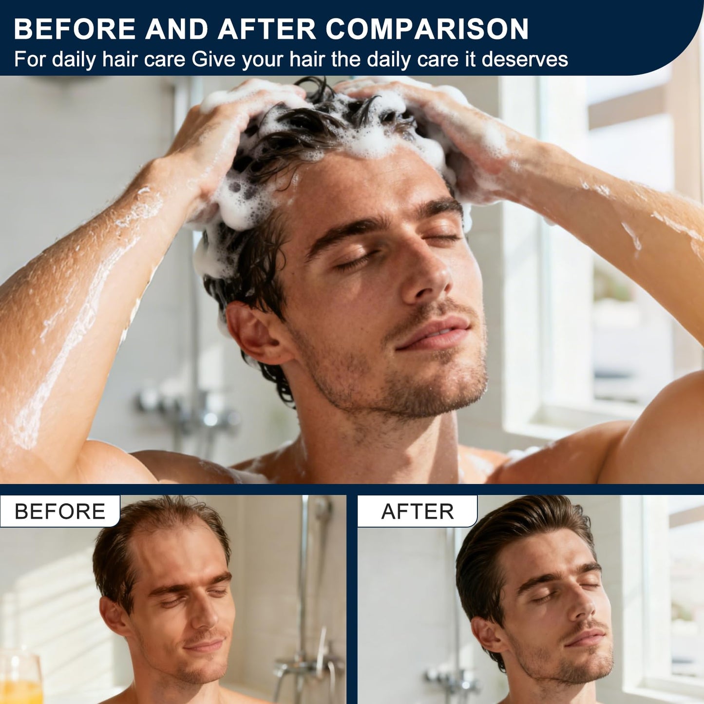 Miracle TQ Root Activator Shampoo for Men & Women - Anti Hair Loss & Mens Hair Regrowth Shampoo with Natural Herbal Ingredients & Biotin - For Scalp Health & Cooling Sensation, 10.1 Fl Oz /300ml