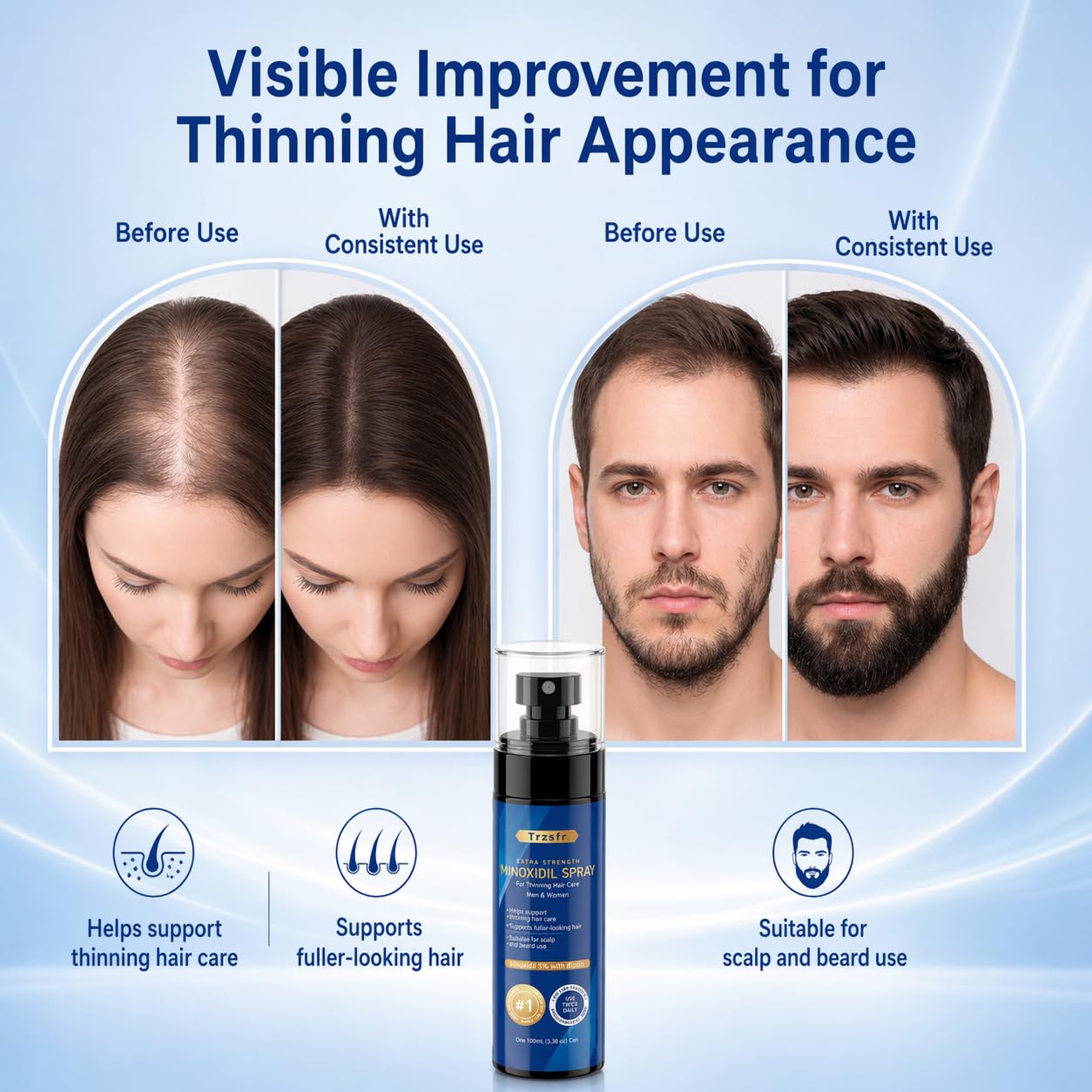 5% Minoxidil Spray for Men & Women with Roller Applicator, 5 Pack Hair Regrowth Treatment Infused with Biotin, Direct Bottle Connection for Precise Scalp & Beard Application, 16.9oz 8 Month Supply
