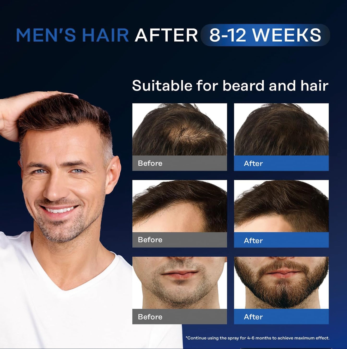 YURHERSU Hair Growth Serum with 5% Minoxidil, Restore Thinning Hair Reduce Hair Loss, Stimulate New Hair Nursing Scalp for Women Men Get Stronger Thicker Longer Hair or Beard-60ml
