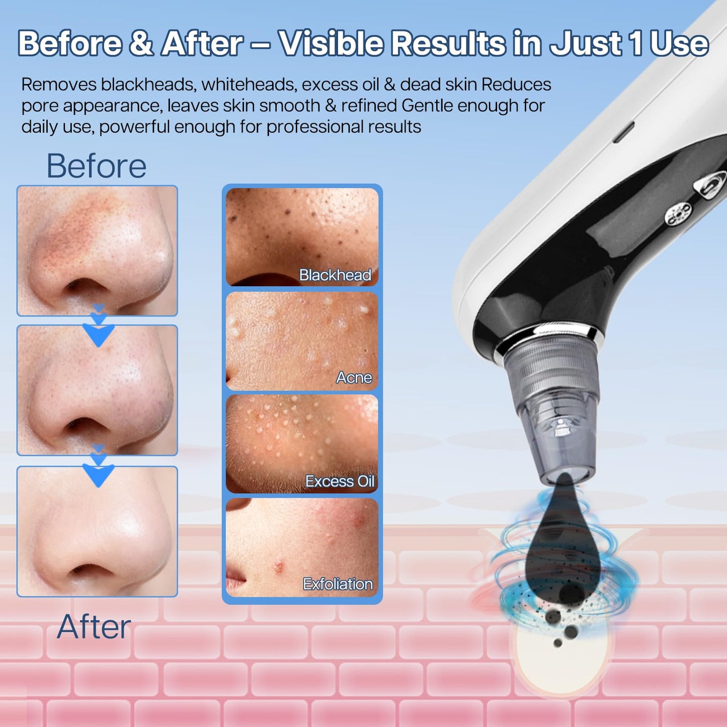 WillowGlow Heated Pore Vacuum, Blackhead Remover with Strong 3-Level Suction, 5 Nozzles for Deep Cleaning Face, Nose & Sensitive Skin, Professional Pore Extractor & Facial Kit