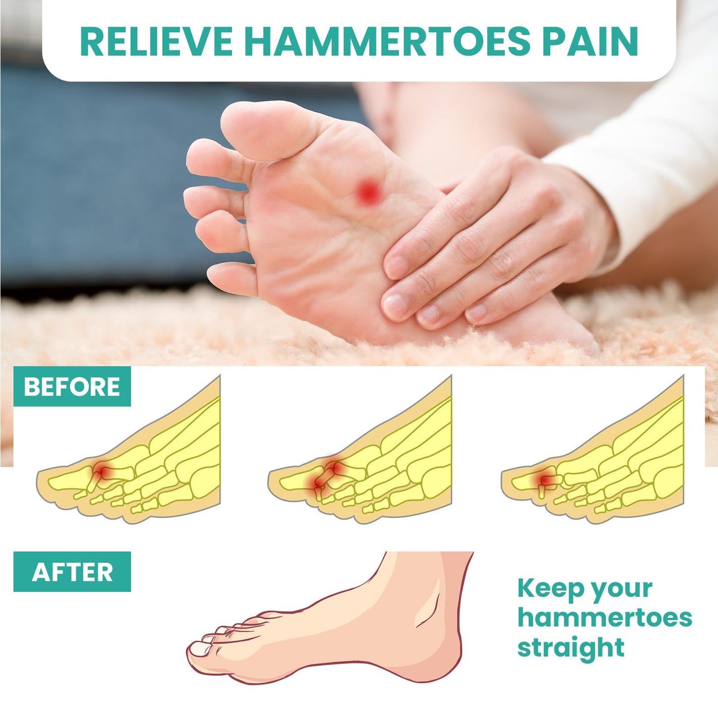 Welnove Hammer Toe Straightener Toe Corrector for Women - 8 Pcs Hammer Toe Cushion Pads for Bent, Crooked, Curled, Claw, and Hammer Toes - Soft Support and Realignment(Clear, 3 Loop Design)