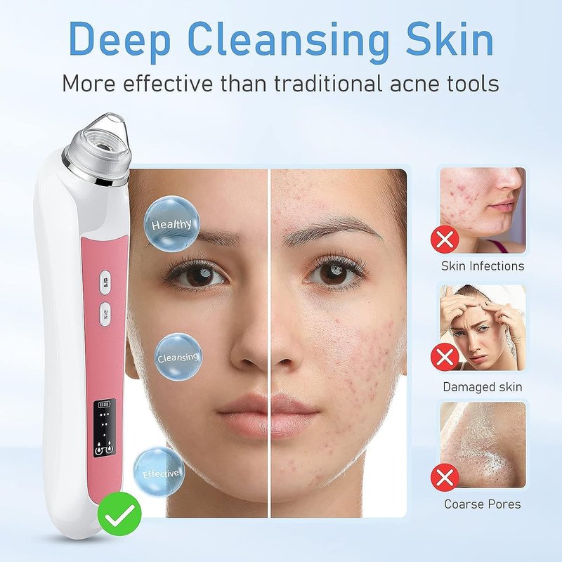 Blackhead Remover Vacuum - USB Pore Cleaner with Camera | 3 Modes & 6 Suction Heads, Light Pink