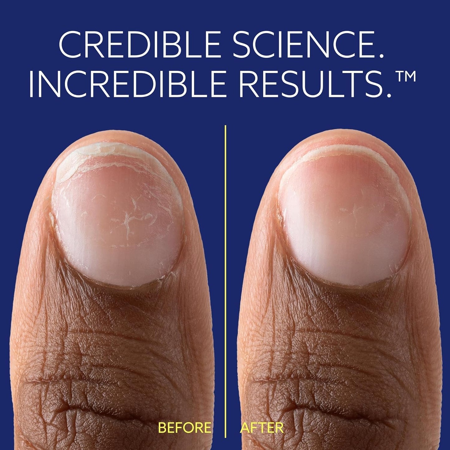 Bond Repair Nail Treatment - Strengthens & Restores Brittle Nails | Ideal for Damaged & Post-Gel Nails